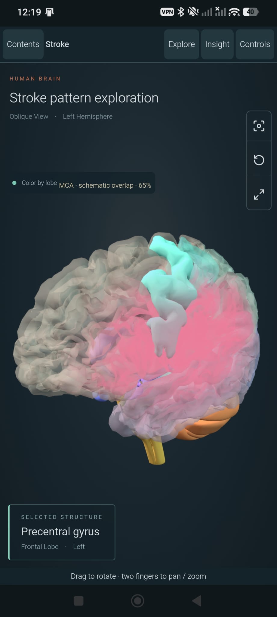 Stroke Pattern Exploration — NeuroAnatomy Android screen